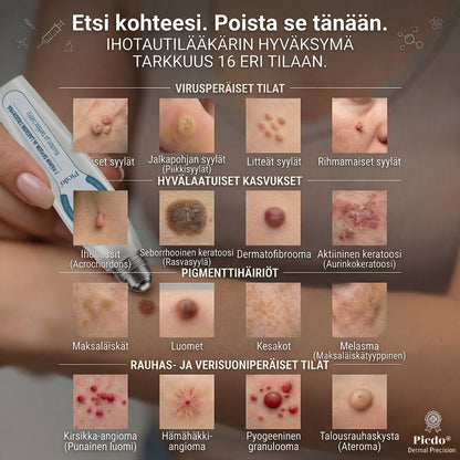 𝐏i𝐜𝐝o®𝟕 𝐏ä𝐢𝐯ä𝐧 𝐋𝐮𝐨𝐦𝐢- 𝐣𝐚 𝐍ä𝐩𝐩𝐲-𝐄𝐫𝐤𝐤𝐞𝐫𝐢(𝐊𝐢𝐯𝐮𝐭𝐨𝐧, 𝐣ä𝐥𝐣𝐞𝐭ö𝐧 𝐫𝐨𝐥𝐥-𝐨𝐧-𝐩𝐚𝐥𝐥𝐨） 👀