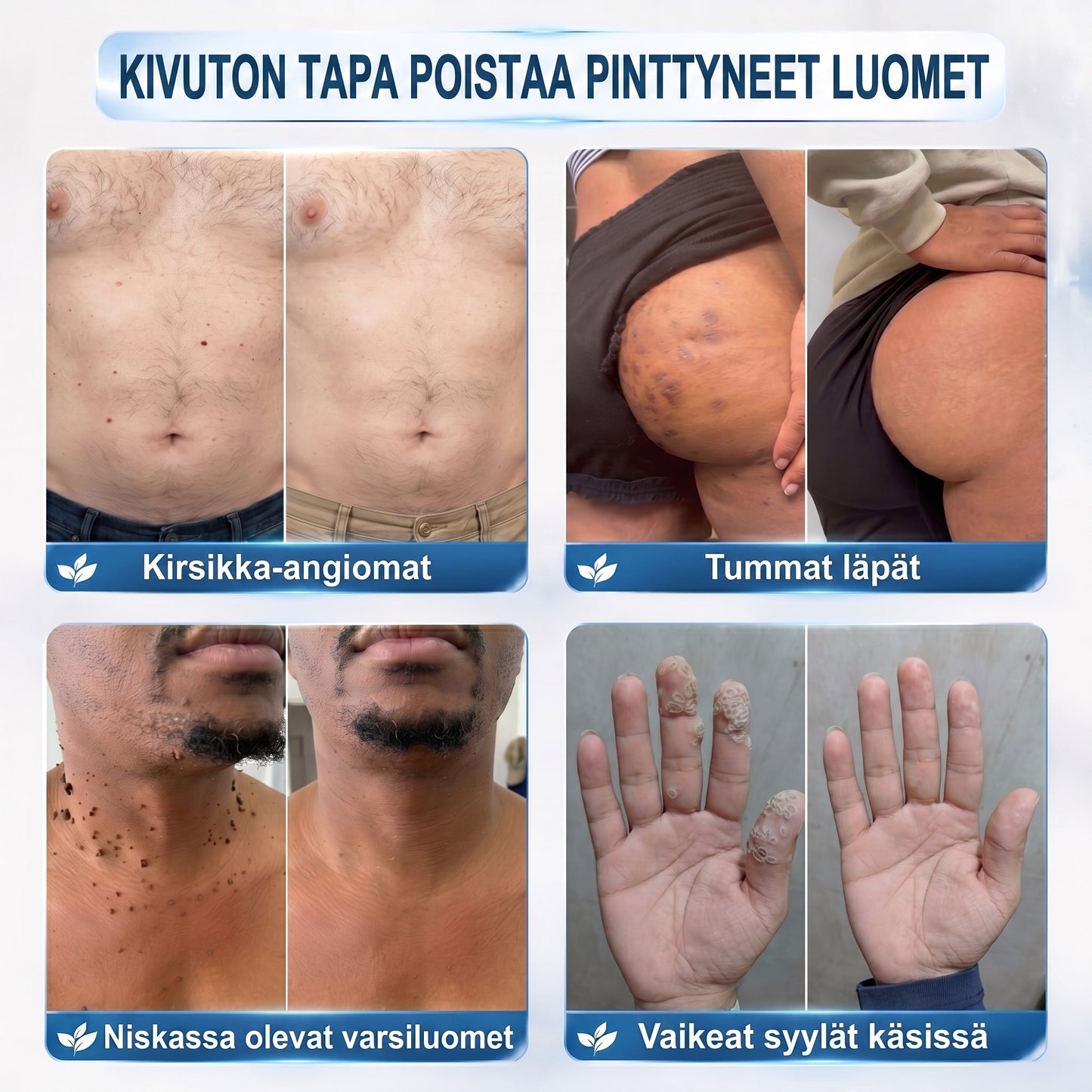𝐏i𝐜𝐝o®𝟕 𝐏ä𝐢𝐯ä𝐧 𝐋𝐮𝐨𝐦𝐢- 𝐣𝐚 𝐍ä𝐩𝐩𝐲-𝐄𝐫𝐤𝐤𝐞𝐫𝐢(𝐊𝐢𝐯𝐮𝐭𝐨𝐧, 𝐣ä𝐥𝐣𝐞𝐭ö𝐧 𝐫𝐨𝐥𝐥-𝐨𝐧-𝐩𝐚𝐥𝐥𝐨） 👀
