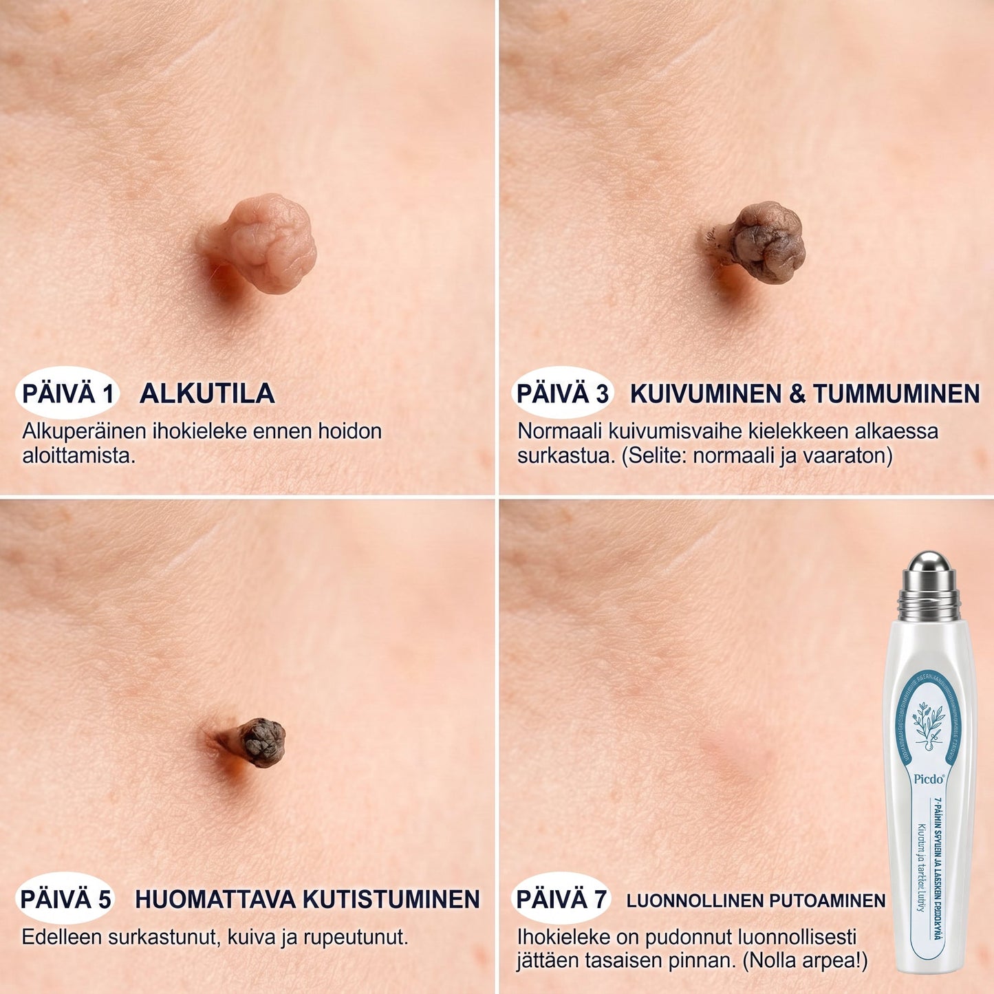 𝐏i𝐜𝐝o®𝟕 𝐏ä𝐢𝐯ä𝐧 𝐋𝐮𝐨𝐦𝐢- 𝐣𝐚 𝐍ä𝐩𝐩𝐲-𝐄𝐫𝐤𝐤𝐞𝐫𝐢(𝐊𝐢𝐯𝐮𝐭𝐨𝐧, 𝐣ä𝐥𝐣𝐞𝐭ö𝐧 𝐫𝐨𝐥𝐥-𝐨𝐧-𝐩𝐚𝐥𝐥𝐨） 👀