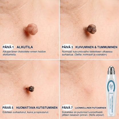 𝐏i𝐜𝐝o®𝟕 𝐏ä𝐢𝐯ä𝐧 𝐋𝐮𝐨𝐦𝐢- 𝐣𝐚 𝐍ä𝐩𝐩𝐲-𝐄𝐫𝐤𝐤𝐞𝐫𝐢(𝐊𝐢𝐯𝐮𝐭𝐨𝐧, 𝐣ä𝐥𝐣𝐞𝐭ö𝐧 𝐫𝐨𝐥𝐥-𝐨𝐧-𝐩𝐚𝐥𝐥𝐨） 👀